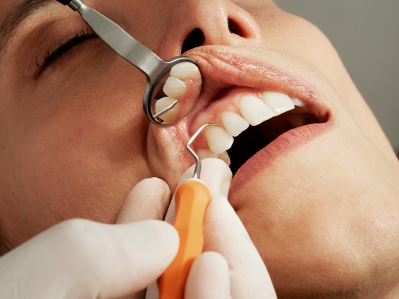 зубний стоматолог