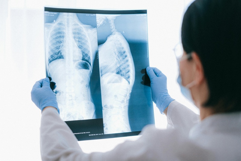 Обзор основных видов рентгенологического оборудования